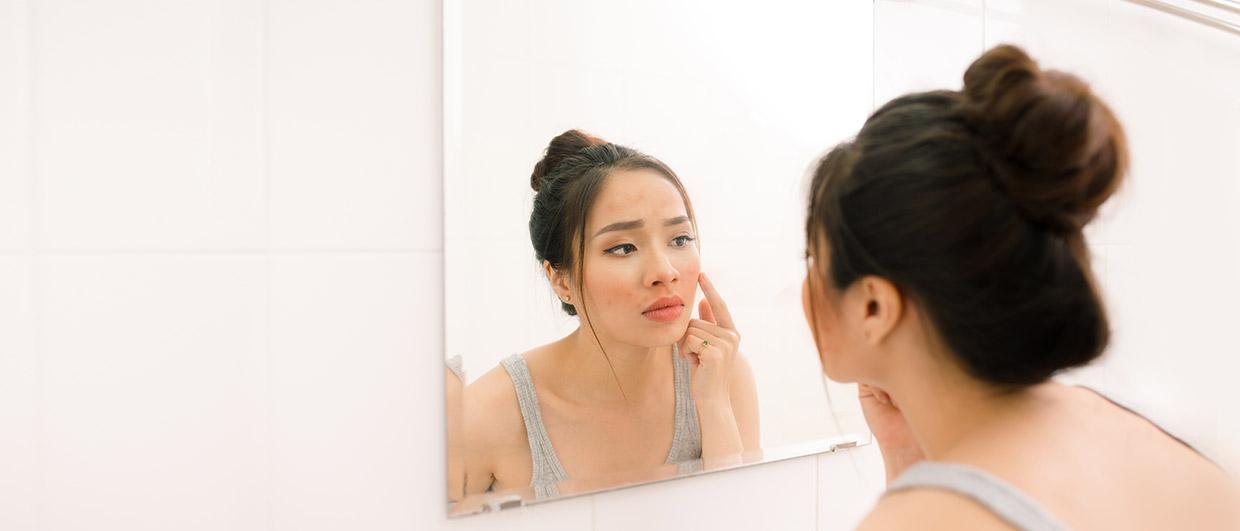 Acne scar treatment mistakes to avoid